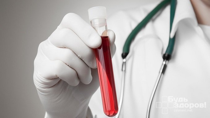 Для определения уровня PLT необходимо сдать общий анализ крови