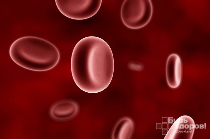 Тромбоцитемия - увеличение количества тромбоцитов в крови и склонность к кровотечениям