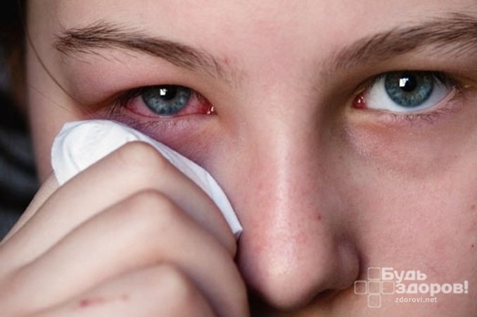 Чувство жжения - один из симптомов инородного тела в глазу