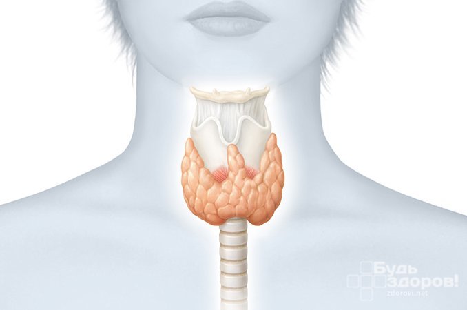 Диффузный токсический зоб - увеличение щитовидной железы