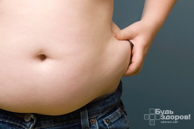 Основной симптом синдрома Иценко-Кушинга - ожирение с неравномерным распределением жировых отложений