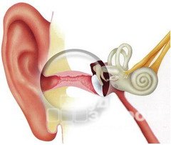 Отит — воспаление среднего уха