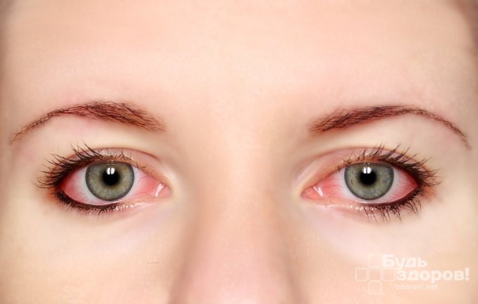 Кровоизлияние в глаз: причины и лечение