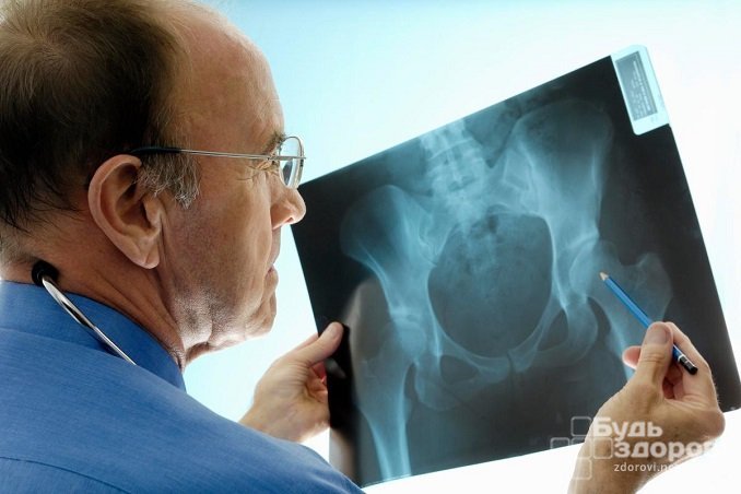Рентгеновское облучение может стать причиной повышения уровня ФСГ у мужчин