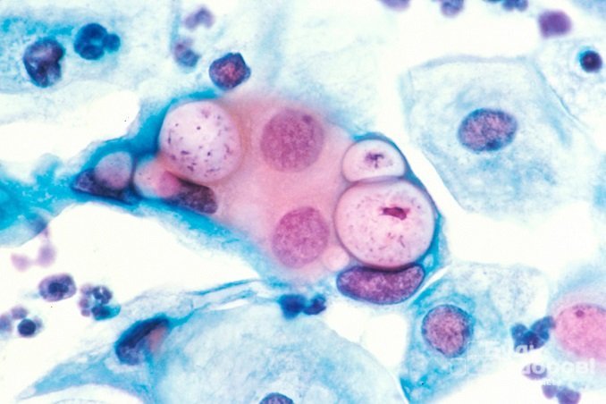Chlamydia trachomatis – возбудитель хламидиоза у мужчин