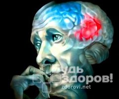 Приобретенное слабоумие - болезнь Альцгеймера