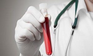 PLT в анализе крови: что это такое, норма и отклонения