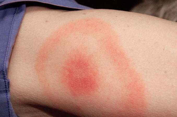 Малыш 1 месяц болит живот
