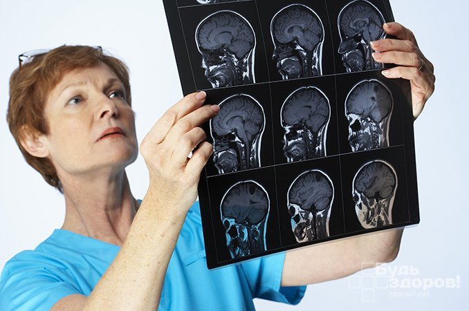 Сильные головные боли и рвота - симптомы абсцесса головного мозга