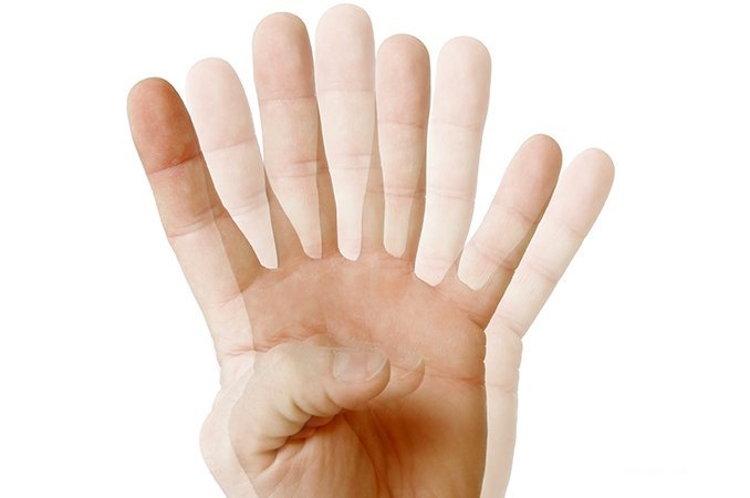 Диплопия - нарушение зрения, характеризующееся двоением в глазах