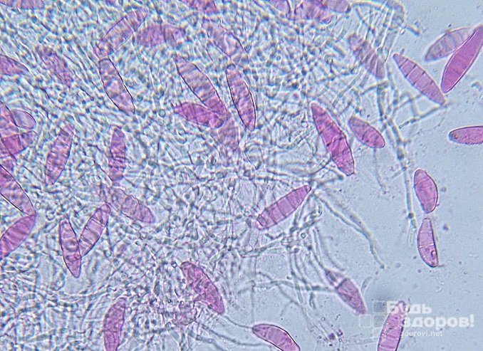 Microsporum – возбудитель стригущего лишая