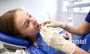 Причины белых пятен на зубах 