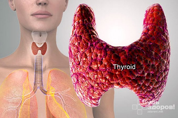 Группа заболеваний щитовидной железы - тиреоидит