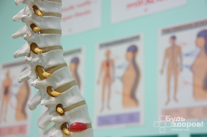 Травма спины - одна из причин образования кисты позвоночника