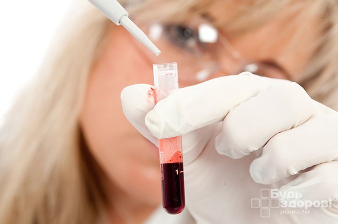 Хилез крови - повышенное содержание триглицеридов