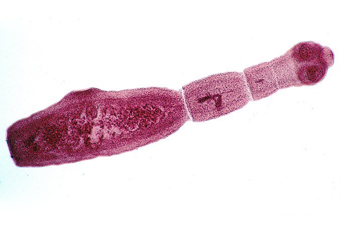 Личинка ленточного гельминта - возбудитель эхинококкоза
