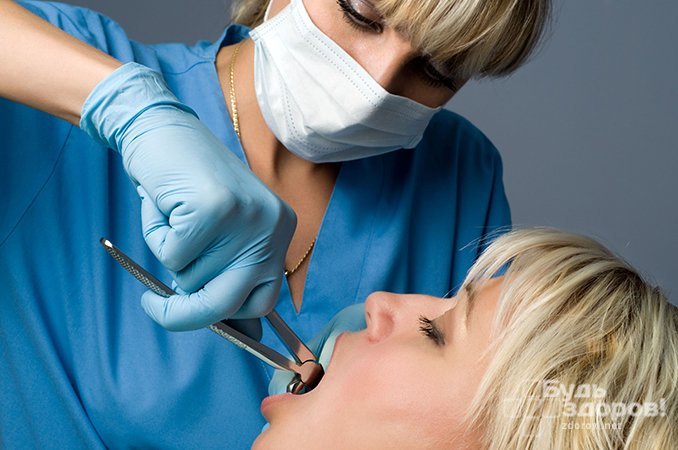 Развитие инфекции - одна из причин удаления зуба