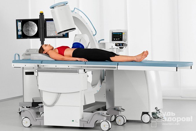 Портативные рентгеновские аппараты - необходимость в современной медицине