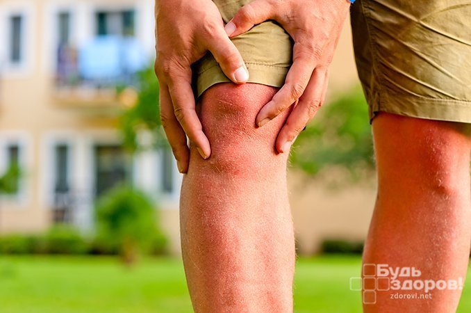 Ушиб колена - одна из самых частых травм нижних конечностей