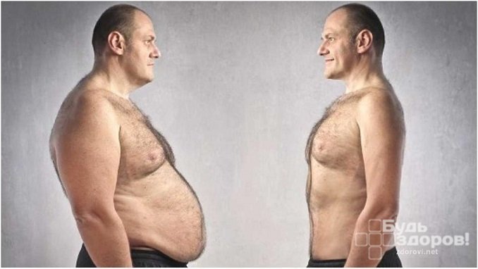 О повышении уровня эстрадиола у мужчин может свидетельствовать ожирение по женскому типу