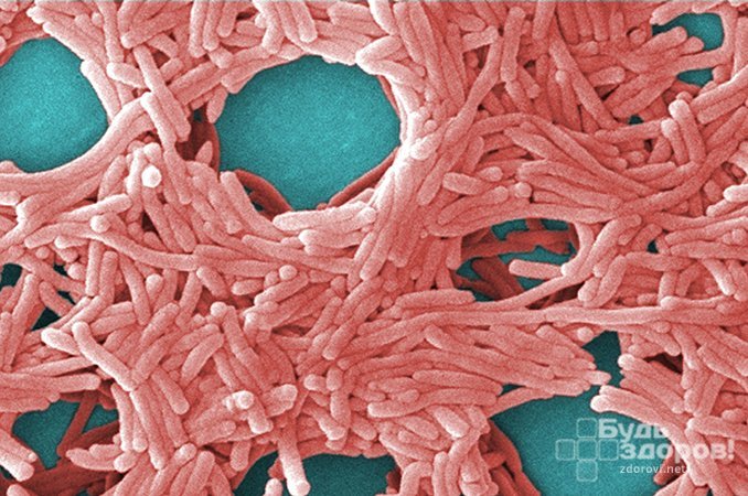 Legionella pneumophilia - возбудитель болезни легионеров