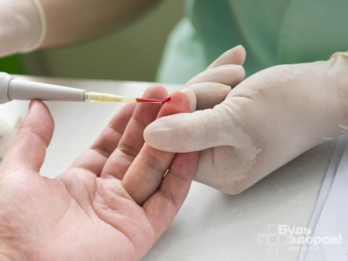 Кровь для анализа крови берется из пальца или вены