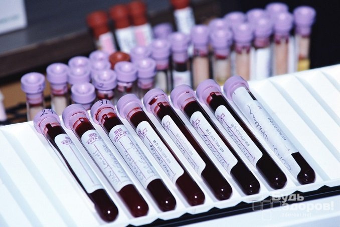 Кровь собирают в пробирку, после чего в течение 1–2 часов относят в лабораторию непосредственно для анализа