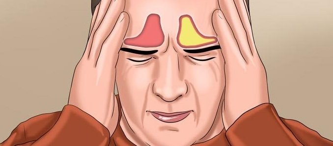 Острый и хронический фронтит у детей и взрослых – симптомы, лечение