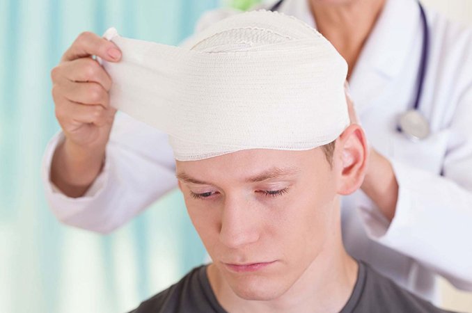 Лечение последствий черепно мозговой травмы