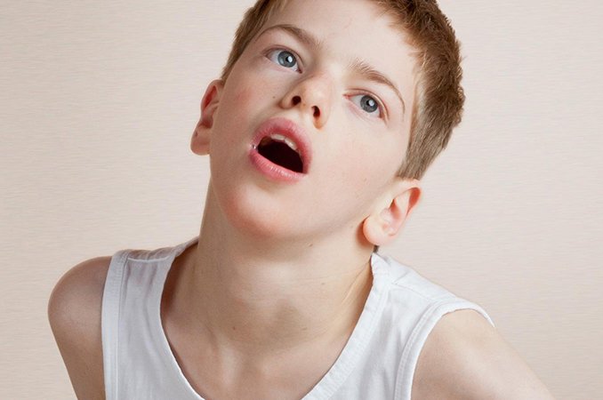 Дистония – симптомы, лечение, виды, диагностика, профилактика