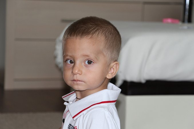 Синдром Денди-Уокера – причины, лечение, прогноз